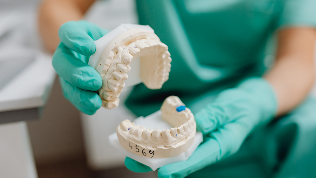 Person holding a white dental cast